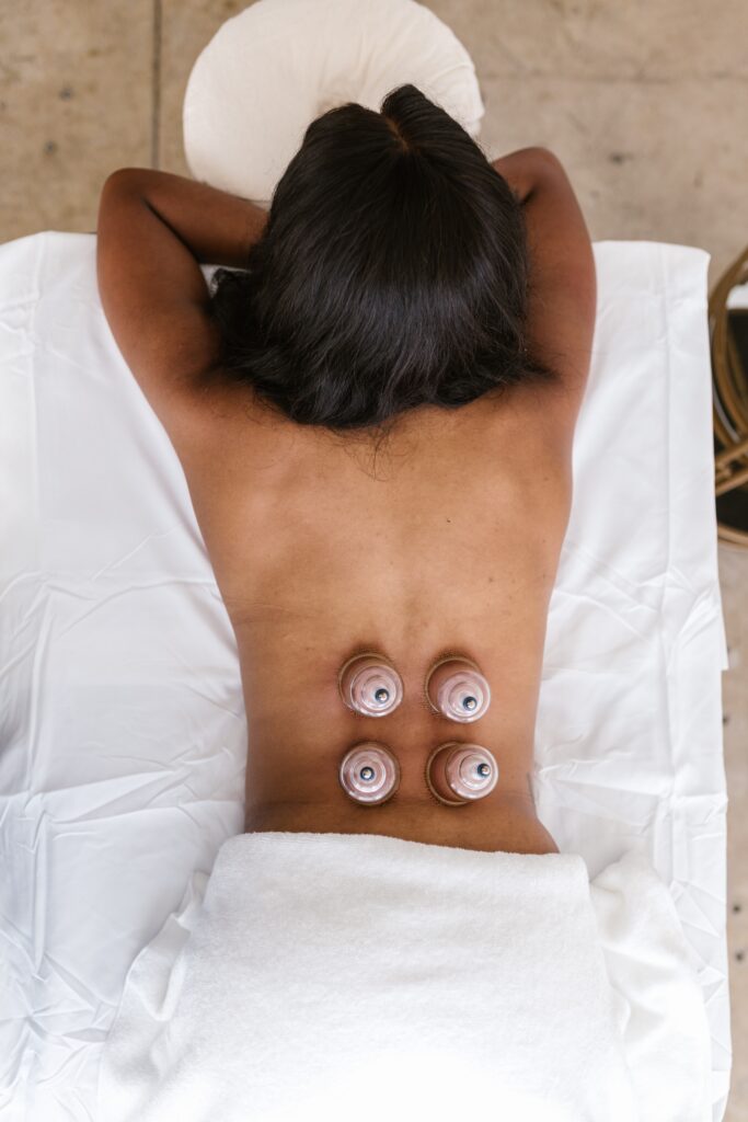 Cupping on lower back